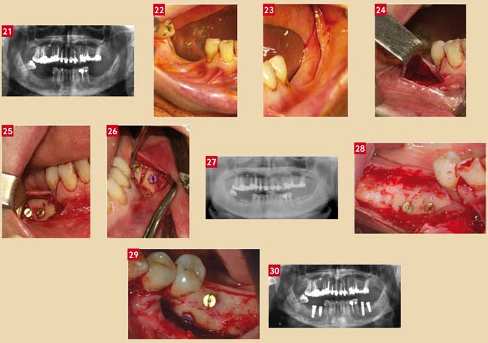 l-aspect-radiologique