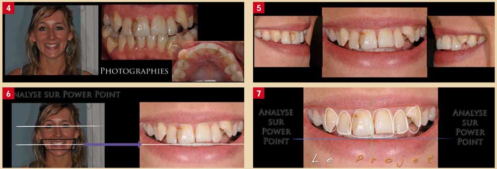 photographies-du-sourire