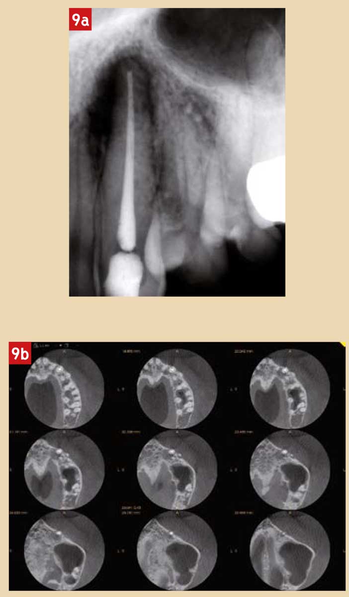 Dentisterie-médico-légale