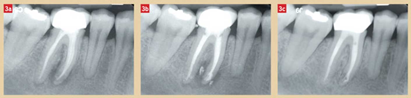 accident-infectieux-de-la-46