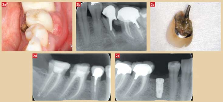 radiographie-de-controle