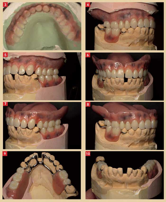 cas-clinique-gestion-esthetique