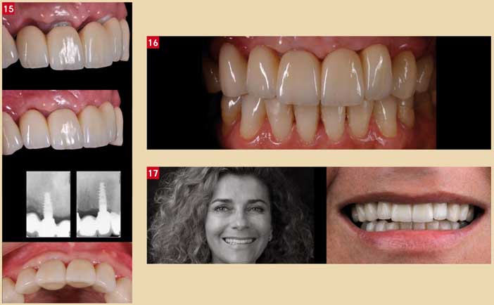 finales-de-la-restauration