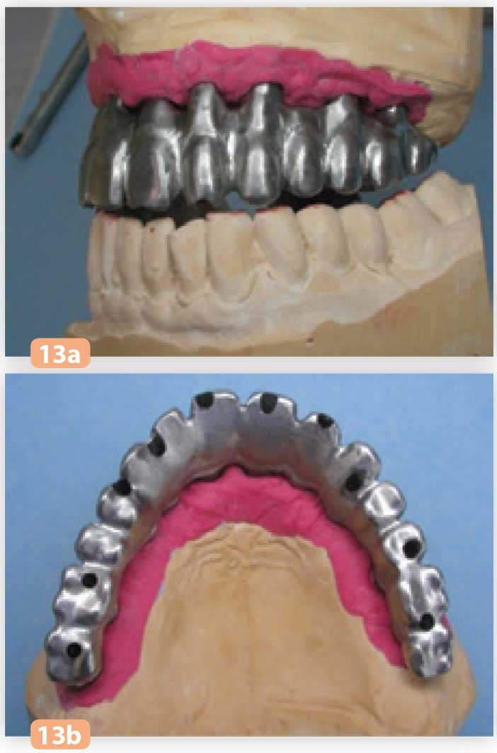 armature-en-titane-usiné