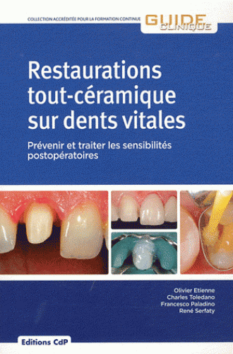 Restaurations tout-céramique