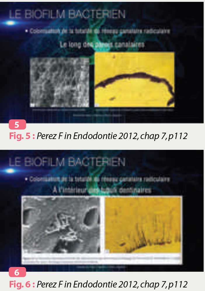 Perez-Fin-Endodontie