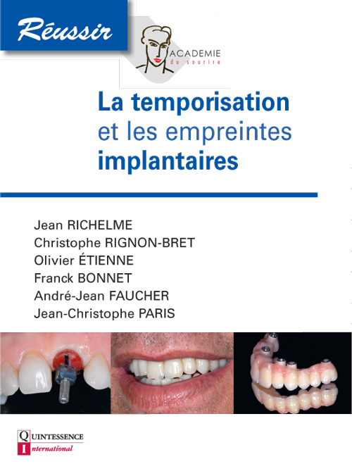 empreintes implantaires