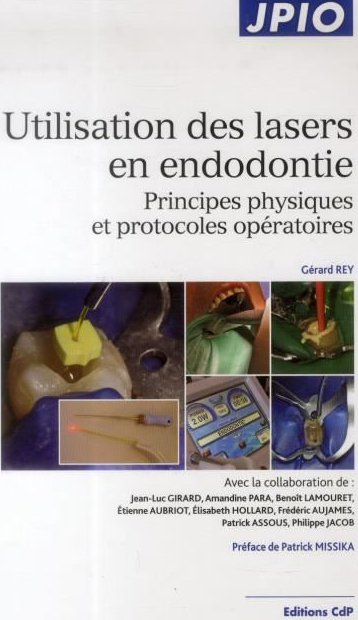 utilisation-des-lasers-en-endodontie