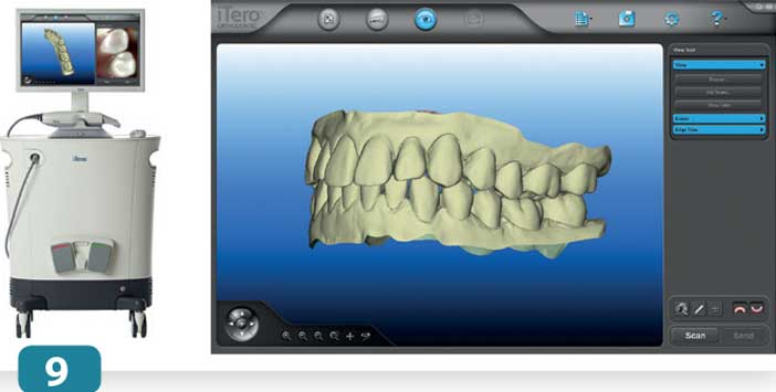 scanner-intra-oral