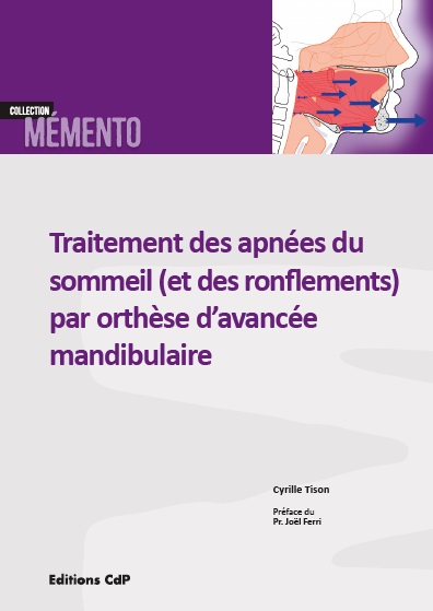 Traitement des apnées du sommeil