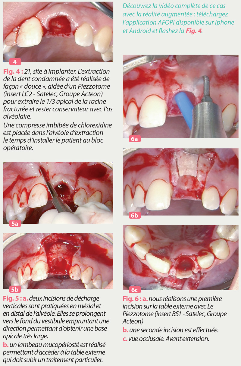 changer-le-paradigme-secteurs-esthetiques-maxillaires