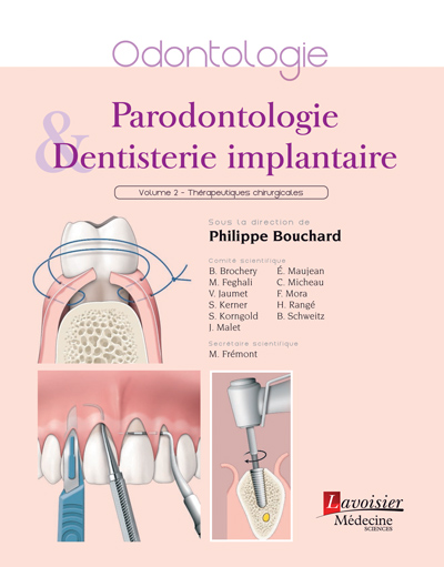 livre-parodontologie-dentisterie-implantaire-lavoisier