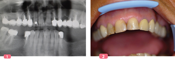 radiographie-panoramique-cas-clinique