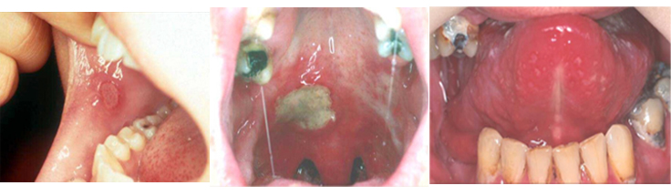 Caractéristiques cliniques et diagnostic