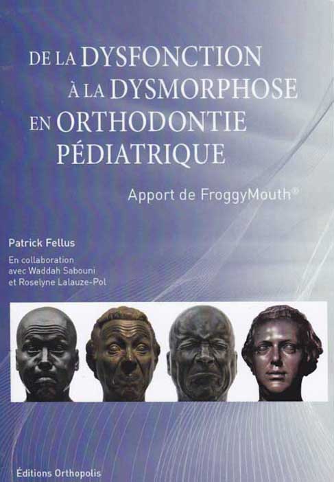 dysmorphose-en-orthodontie