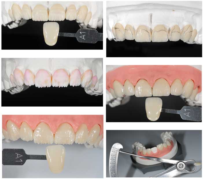 phases-de-stratifications