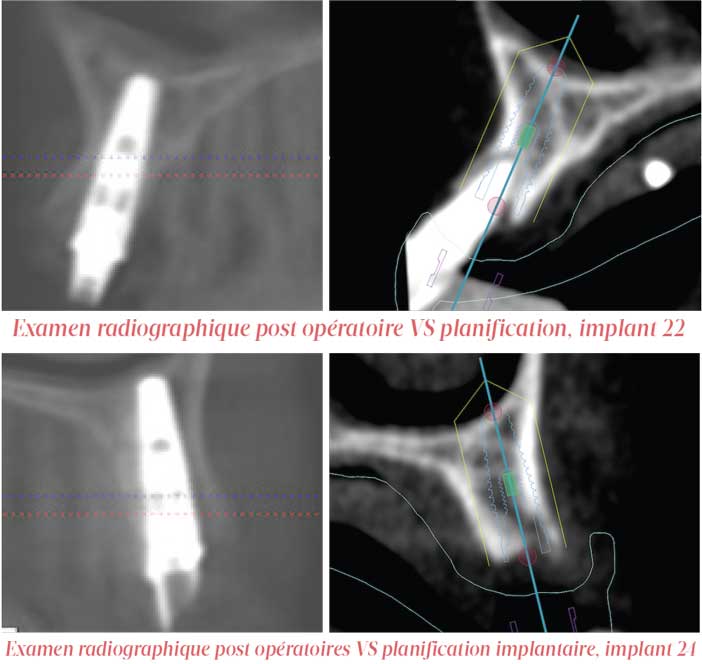 Examen-radiographique-post-opératoire