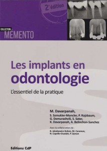 Iimplants-en-odontologie