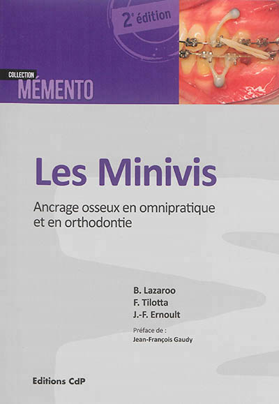 Les minivis