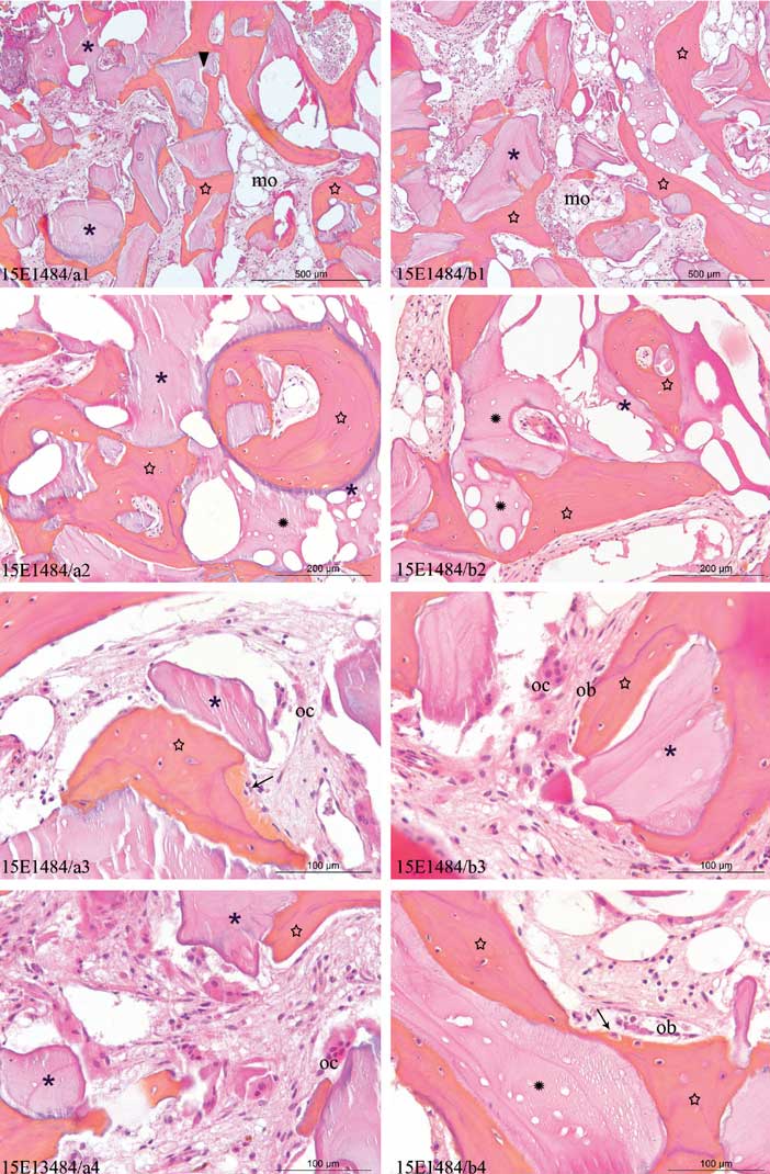 Planche-histologique-d'une-biopsie-de-sinus