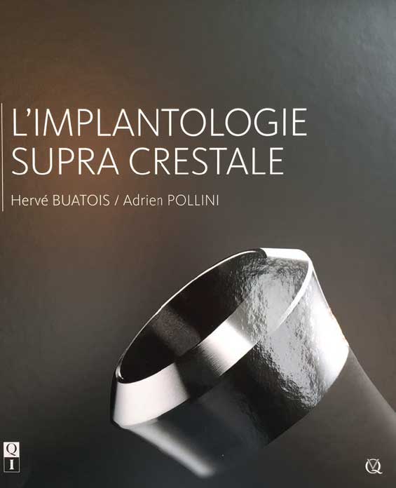 implantologie-supra-crestale