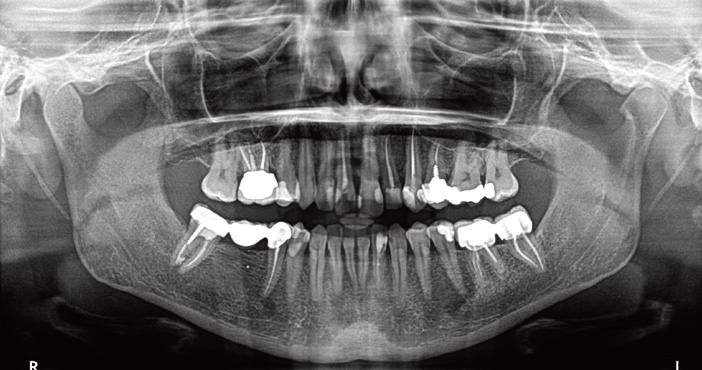 Approche l'imagerie3d en endodontie