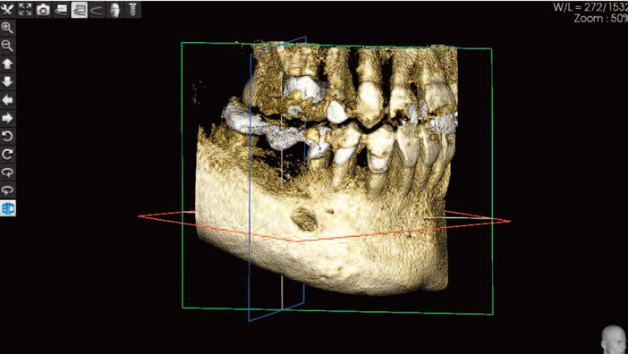 analyse-preoperatoire