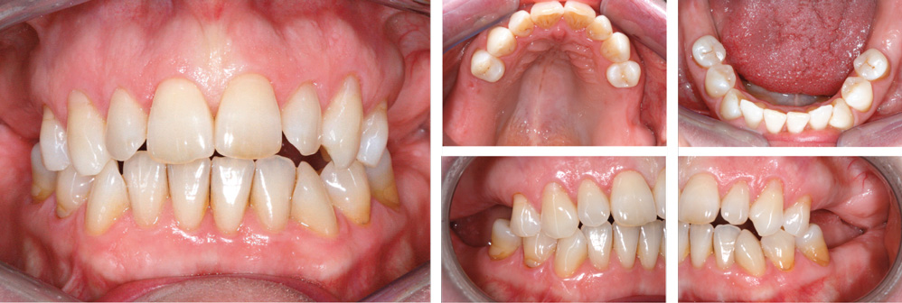 examen-clinique-endobuccal