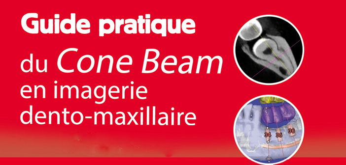 cone-beam-en-imagerie-dento-maxillaire