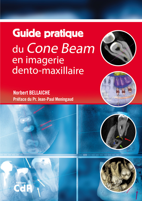 guide-pratique-du-cone-beam