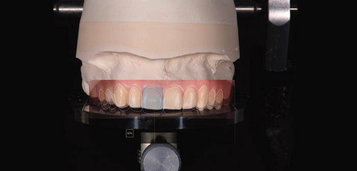 interpretation-du-dsd