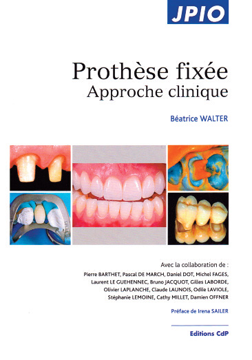 Prothèse-fixée