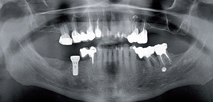 controle-radiographique