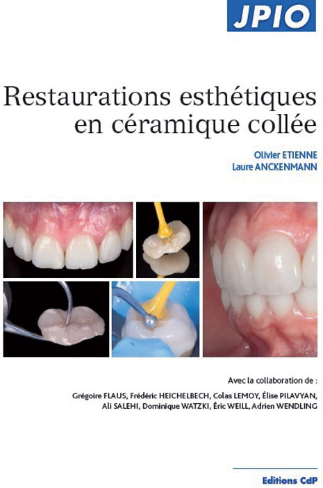 Restauration-esthetiques