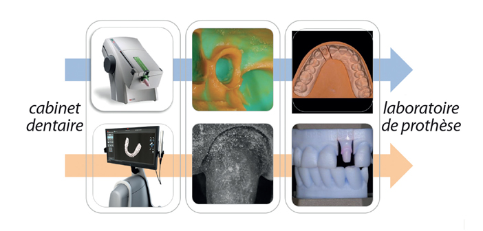 Une approche standardisée de la photographie numérique extra-orale et  intra-orale