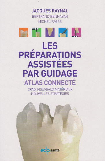 Les-preparations-assistees-par-guidage