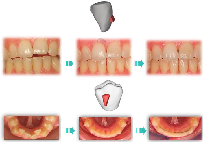 aimable-autorisation-du-Dr-Chazalon