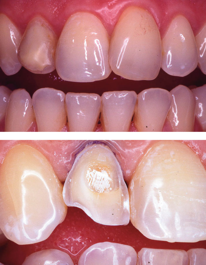 desagrement-esthetique