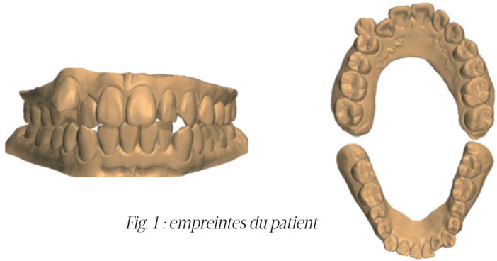 empreintes-du-patient