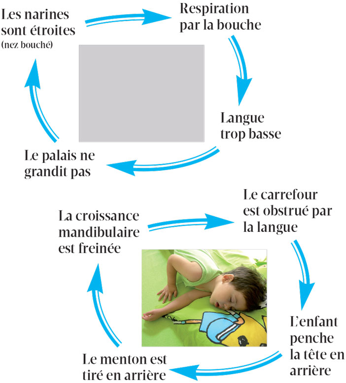 masse-pulmonaire