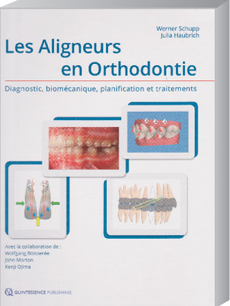 Les-aligneurs-en-orthodontie
