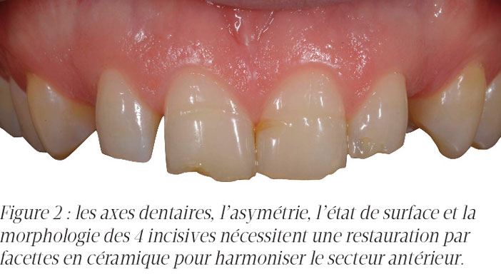 les-axes-dentaires