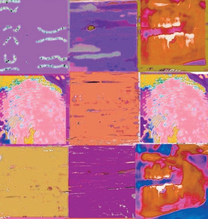 L-ADN mise en peinture