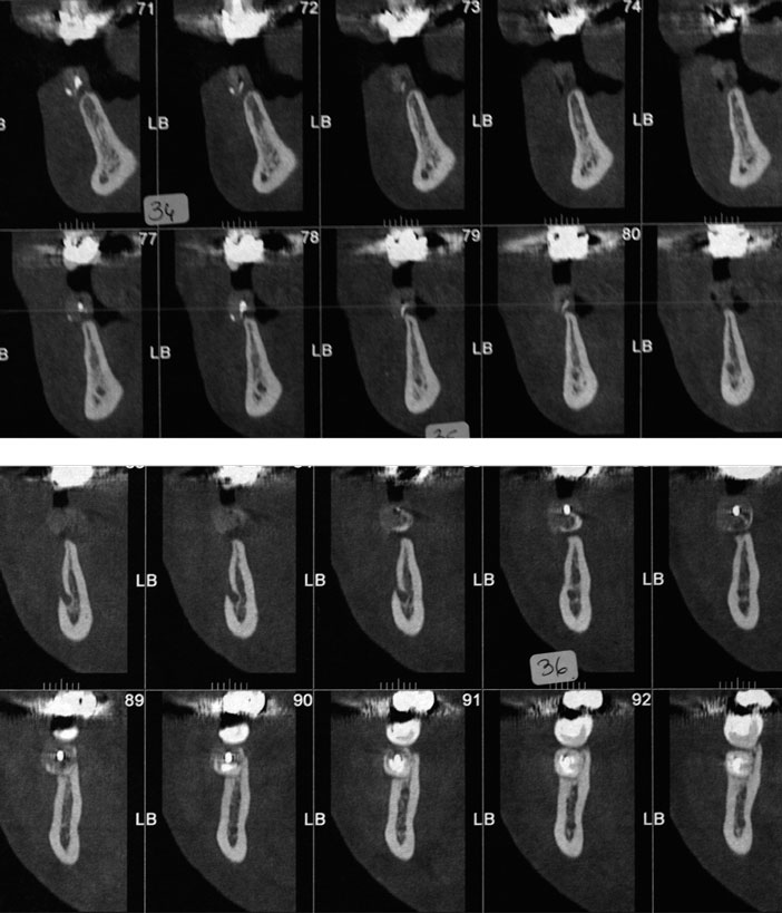 CBCT-dentaire