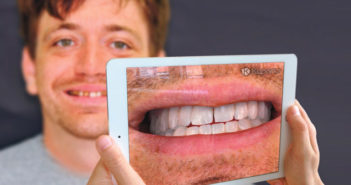 Un logiciel pour projeter son futur sourire Un-logiciel-pour-projeter-son-futur-sourire