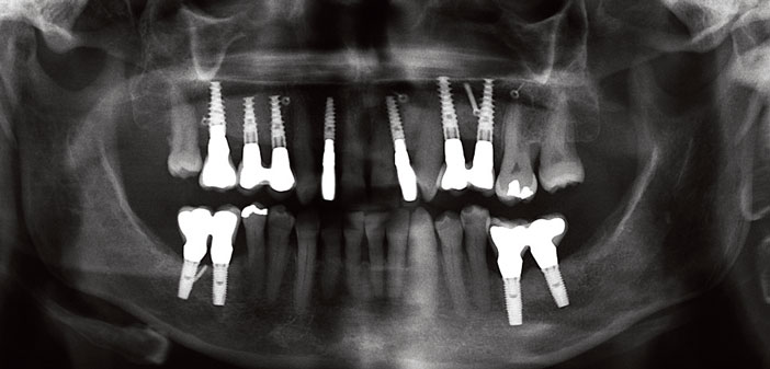 controle-radiographique