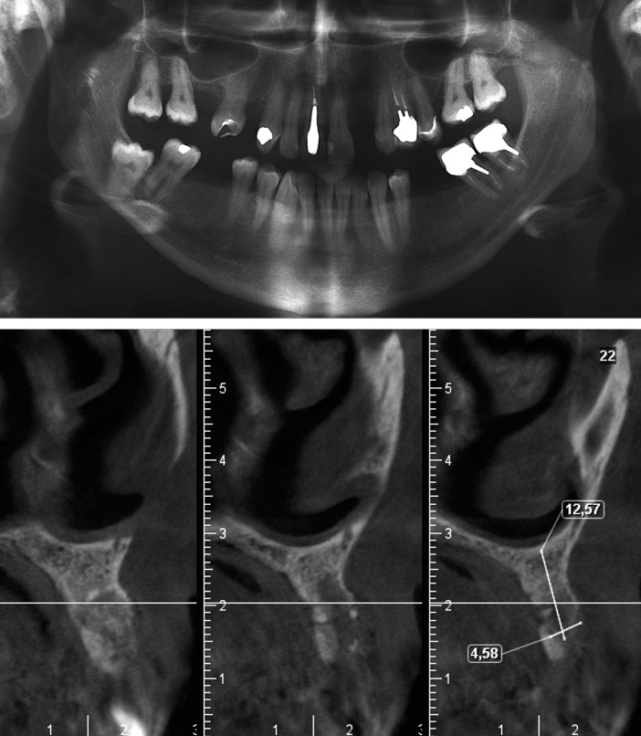 radiographie-panoramique