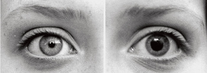 PRESERVER-LA-SANTE-DE-SES-YEUX