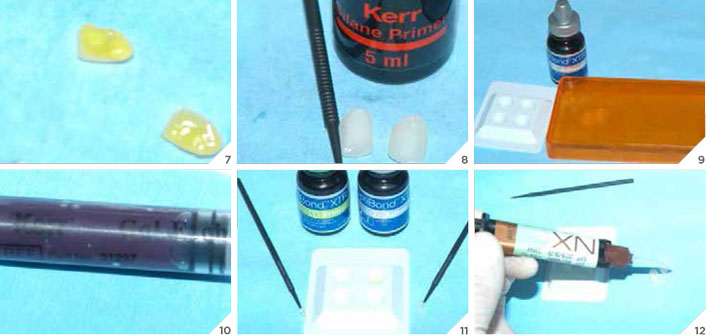 Preparation-de-la-surface-des-facettes