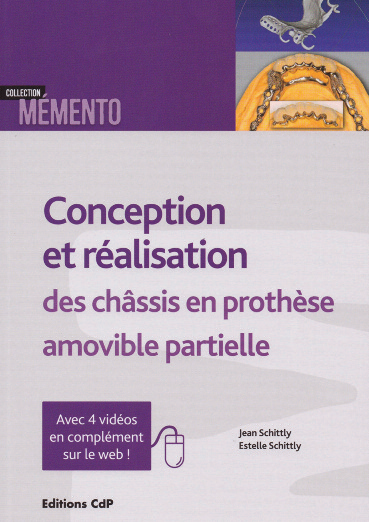 conception et realisation des chassis en prothese amovible partielle